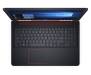 Dell Inspiron 5577 (I5577-5328BLK-PUS)